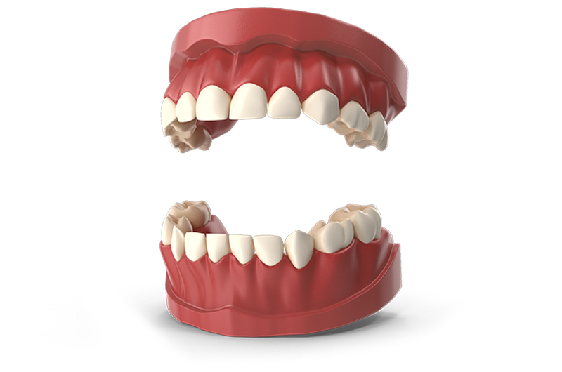 TeethPrimary.I02.2k TeethPrimary.I02.2k